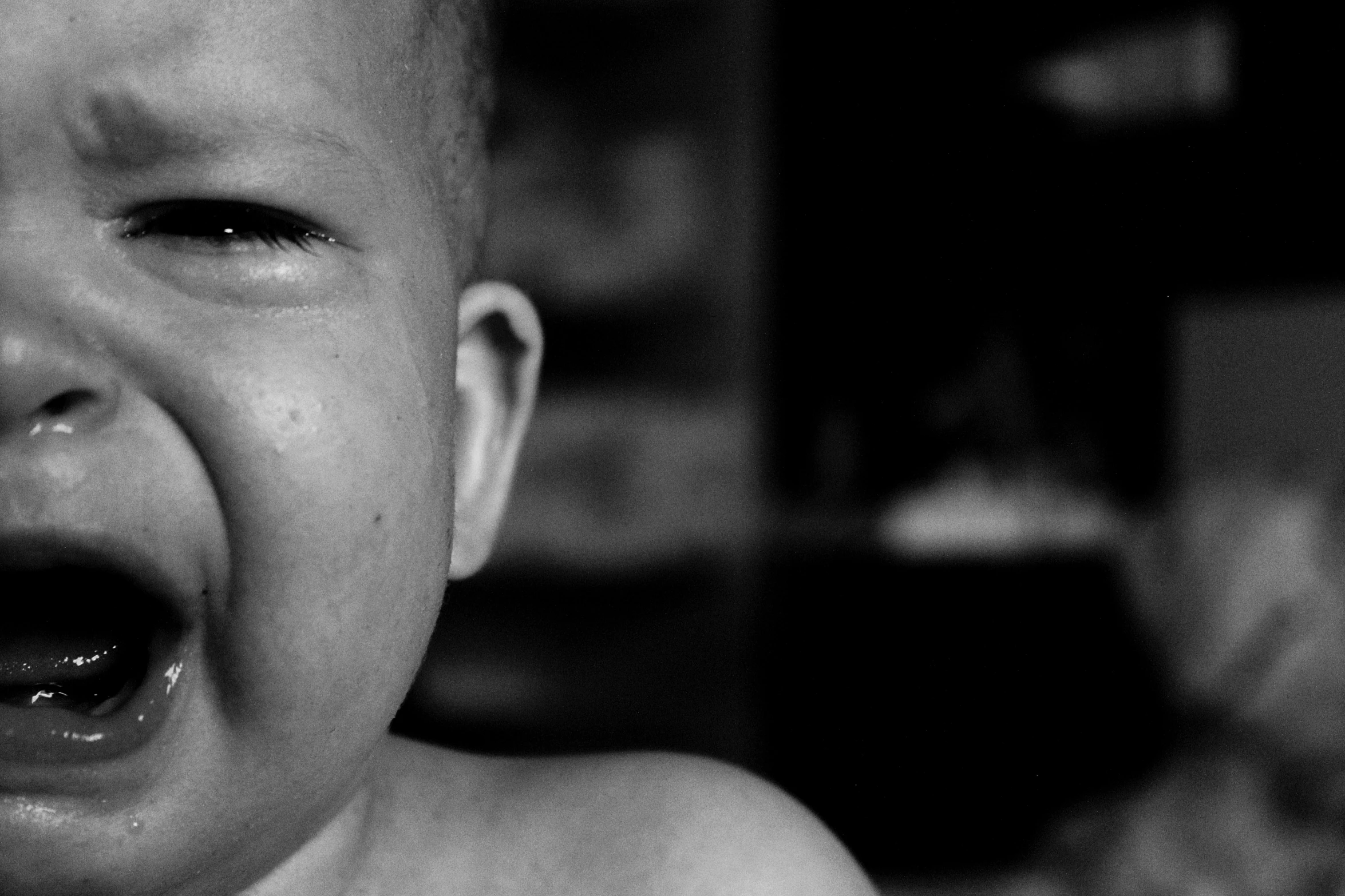 a black and white photo of a baby crying, by Kristian Zahrtmann, pexels contest winner, realism, shaved head, looking at you, albino skin, peruvian boy looking