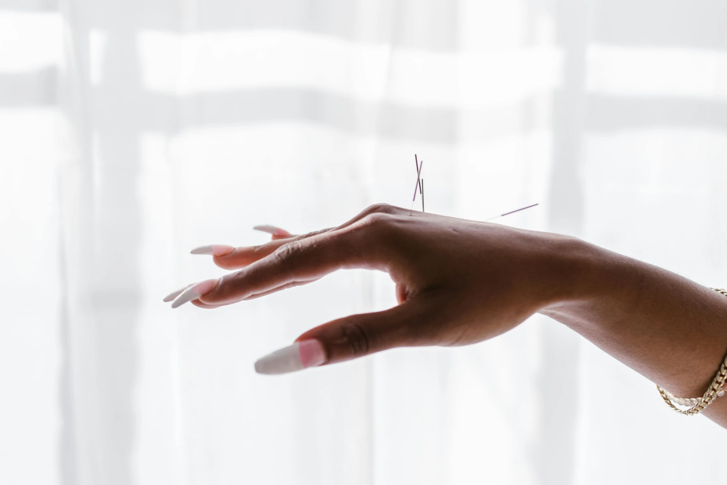 a close up of a person's hand near a window, visual art, acupuncture treatment, large mosquito wings, unclipped fingernails, elegant floating pose