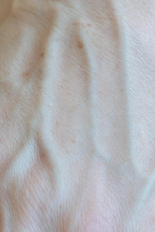 a close up of a person's hand with a ring on it, an ultrafine detailed painting, by Alison Watt, unsplash, facial scar, gradient brown to white, folds of belly flab, square jaw-line