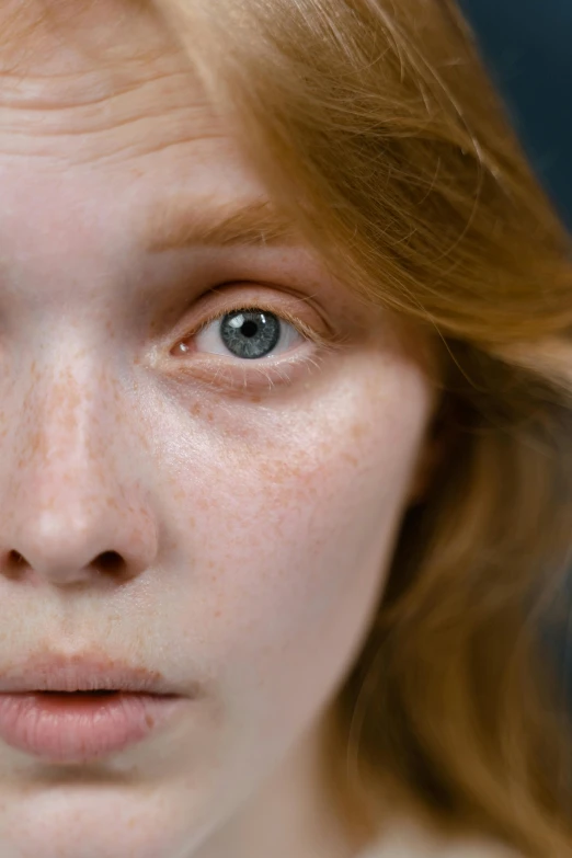 a close up of a woman with freckles on her face, by Tobias Stimmer, flowing ginger hair, white around right eye, reflective skin, 19-year-old girl