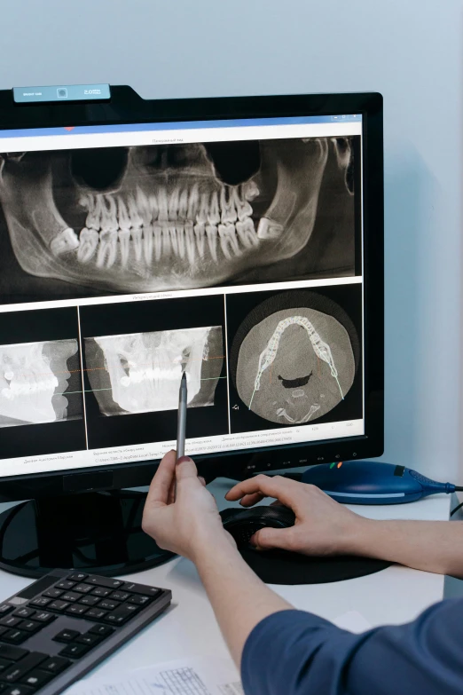 a person sitting at a desk in front of a computer, the jaw showing the teeth, zoomed out to show entire image, surgical supplies, large format picture