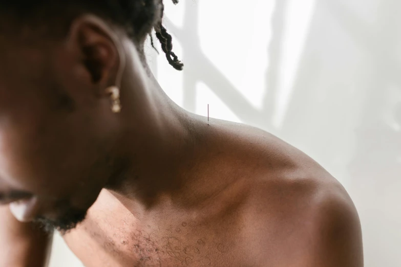 a man with dreadlocks using a cell phone, an album cover, trending on pexels, hyperrealism, acupuncture treatment, showing her shoulder from back, black man, cysts