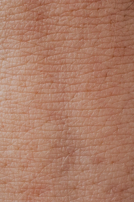 a close up of a person's skin, by David Simpson, hires, arms, natural skin, mild