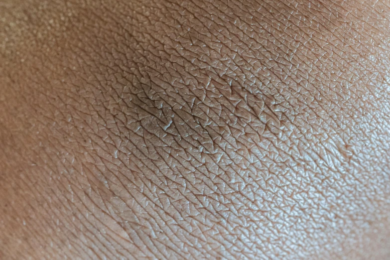 a close up of the skin of an elephant, a stipple, by Alison Watt, trending on pexels, hurufiyya, burn scar left cheek, deep tan skin, textured base ; product photos, creamy skin