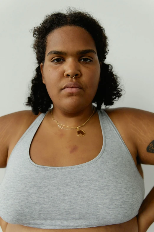 a woman standing with her hands on her hips, featured on reddit, with a bruised face and bruises, wearing gold chain, armpit, light-brown skin