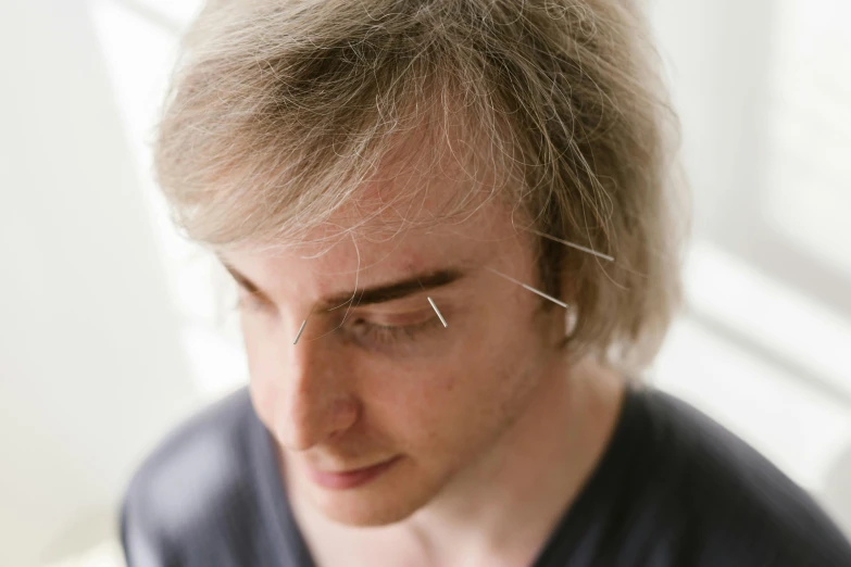 a close up of a person with needles in their hair, inspired by Alexander Kanoldt, thin button nose, gel spiked blond hair, acupuncture treatment, adam ondra