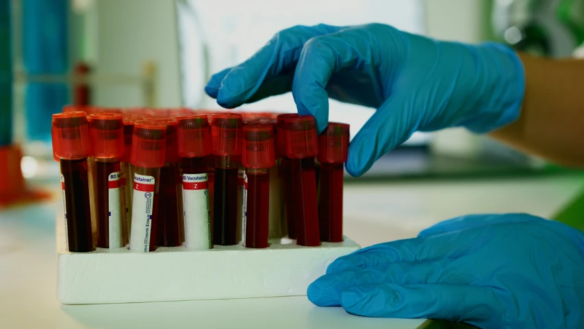 a person in blue gloves holding a tube of blood, a picture, pexels, blood collection vials, brown red blue, australian, panels