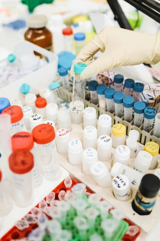 a close up of a person's hand in a glove, vibrant vials, medical labels, stood in a lab, charts