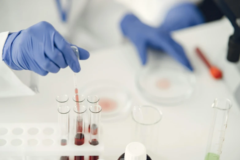 a close up of a person in a lab, purple and red color bleed, medical supplies, on a white table, high samples