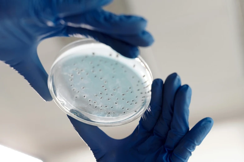 a person in blue gloves holding a petri dish, white fungal spores everywhere, fan favorite, product introduction photo, australia