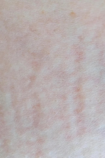 a close up of the skin of a person, trending on pexels, white stripes all over its body, scaly, pale red, square lines