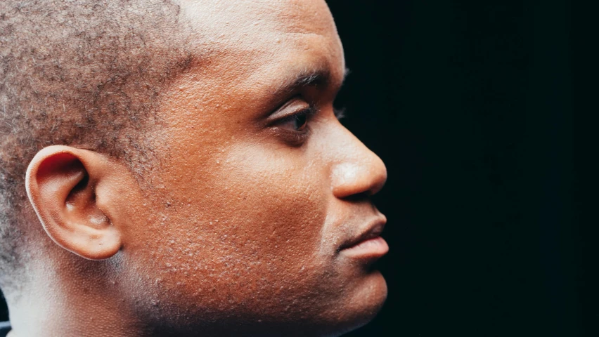 a close up of a man with a shaved head, trending on unsplash, dark black skin tone, side view of a gaunt, noticeable tear on the cheek, grainy photorealistic