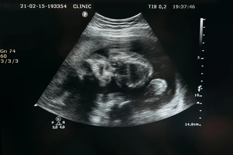 a close up of a person's ultrasound, pexels, massurrealism, round format, poop, hi - res scan, ultra wide 1 0 mm