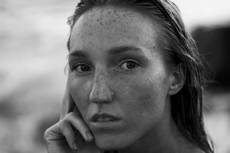 a black and white photo of a woman with freckles on her face, by Sven Erixson, pexels contest winner, realism, sunbathed skin, portrait of maci holloway, tanned beauty portrait, portrait of nordic girl