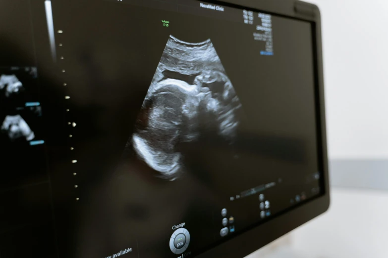 a computer monitor sitting on top of a desk, pexels, massurrealism, membrane pregnancy sac, mri, low quality photo, low - angle shot
