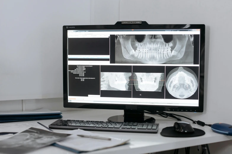 a computer monitor sitting on top of a desk, the jaw showing the teeth, medical imaging, technological screens, thumbnail