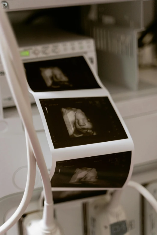 a printer sitting on top of a white counter, a polaroid photo, by Dan Frazier, unsplash, happening, showcases full of embryos, inside a cavernous stomach, still from film, documentary footage