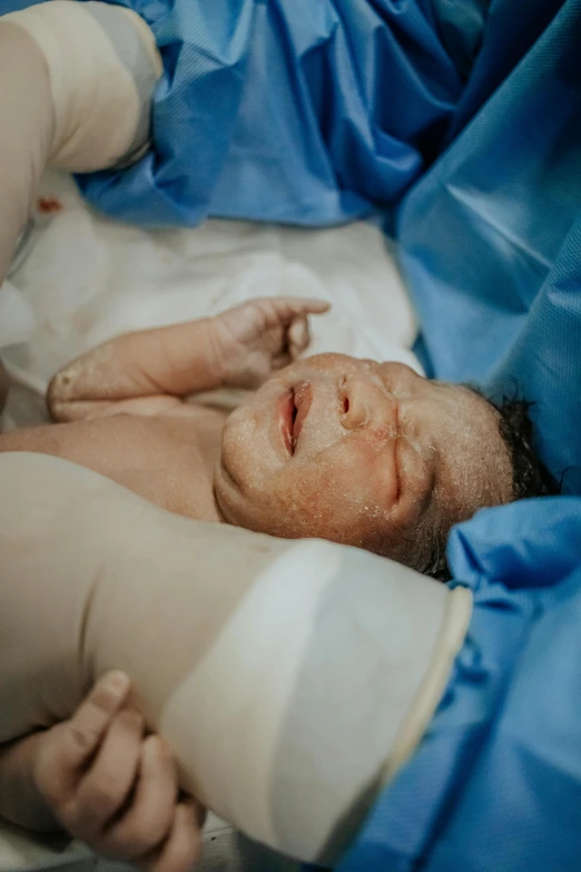 a close up of a baby laying on a bed, by Daniel Lieske, reddit, hyperrealism, surgery, wētā fx, taken in 2022, exploded belly