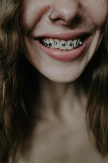 a close up of a person with braces on, a colorized photo, by Adam Marczyński, trending on pexels, black and silver, jewelled, smiling down from above, made of metal