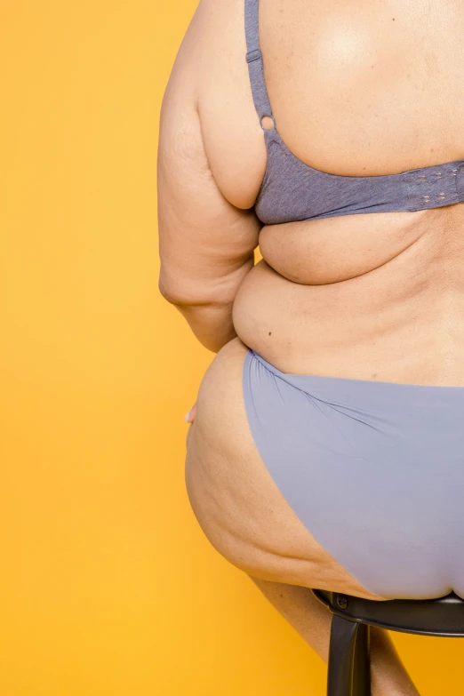 a fat woman sitting on top of a stool, by Hannah Tompkins, trending on pexels, in a yellow bikini, surgery, half turned around, hyperedetailed photo