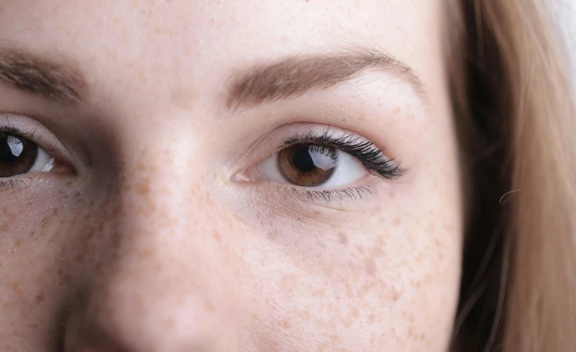 a close up of a woman with freckles on her face, a stipple, trending on pexels, black spot over left eye, heterochromia, low - angle shot, - photorealistic
