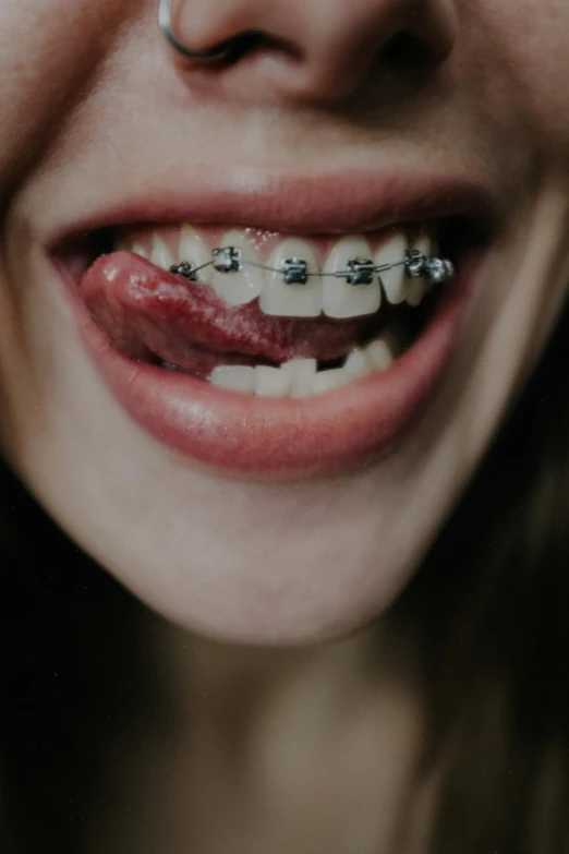 a close up of a person with braces on, an album cover, trending on pexels, pierced, about to consume you, vampire, bracts