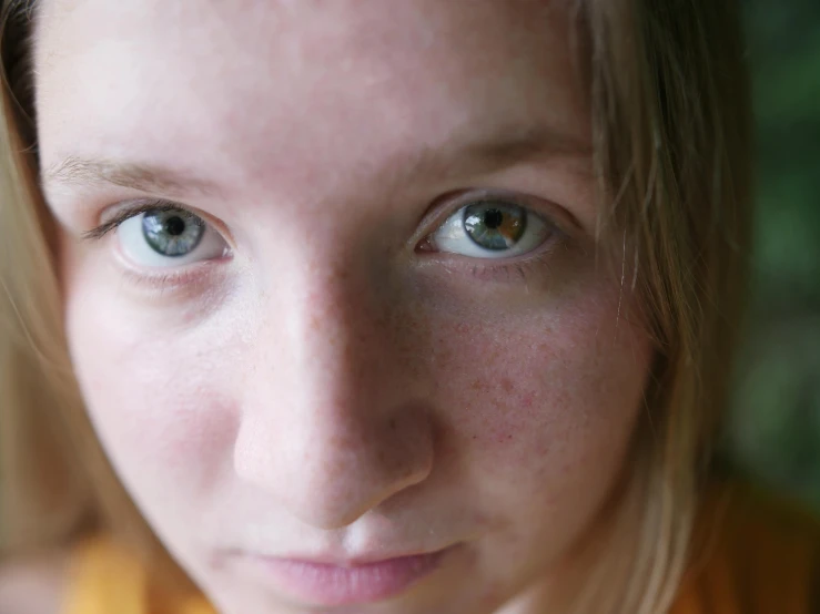 a close up of a woman looking at the camera, freckled pale skin, teenager, no yellow color in eyes, pimples