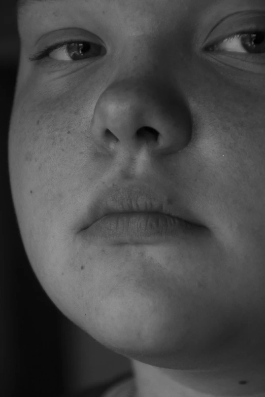 a black and white photo of a young boy, a black and white photo, inspired by Roy DeCarava, unsplash, hyperrealism, a portrait of a plump woman, skin pores, lips, pimples