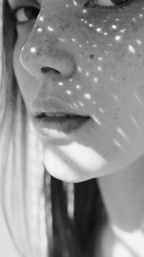 a black and white photo of a woman with freckles on her face, a black and white photo, by Emily Shanks, sun glare, profile image, lip scar, play of light