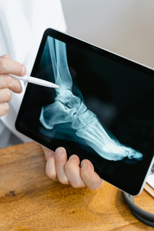 a person holding a tablet with an x - ray image on it, foot, looking left, hoofs, bay area