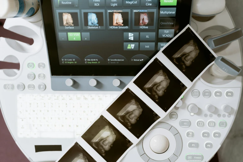 a laptop computer sitting on top of a table, a photocopy, unsplash, holography, showcases full of embryos, medical equipment, femme fetal, monitors