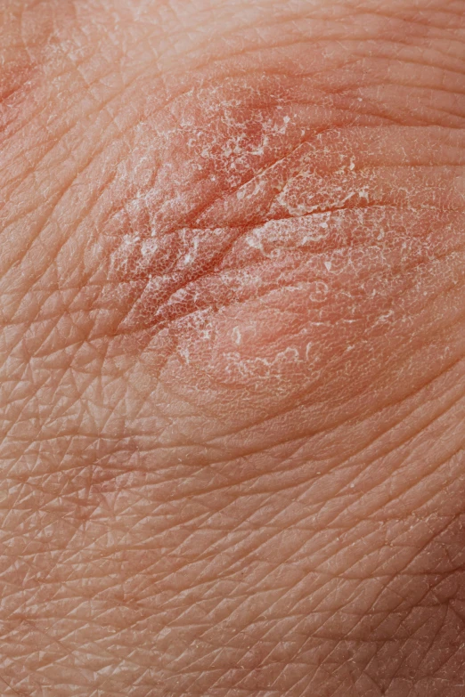 closeup of skin lines showing some red spots