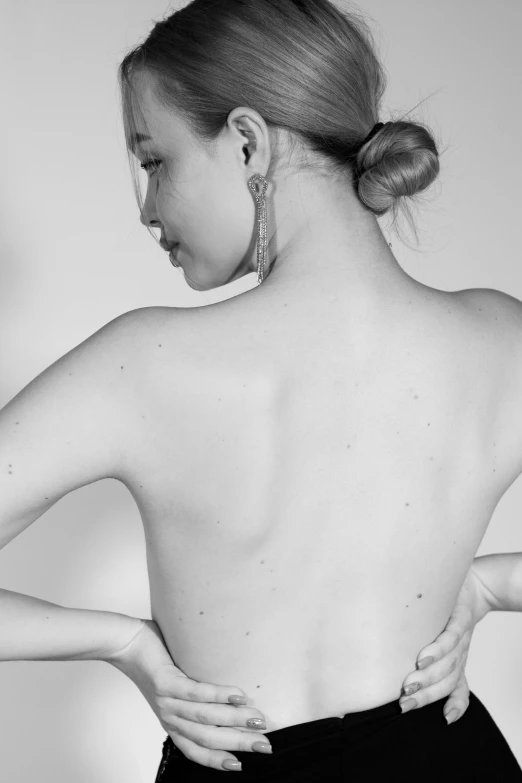 a black and white photo of a woman with her back to the camera, hyperrealism, pimples, promo image, back, hives