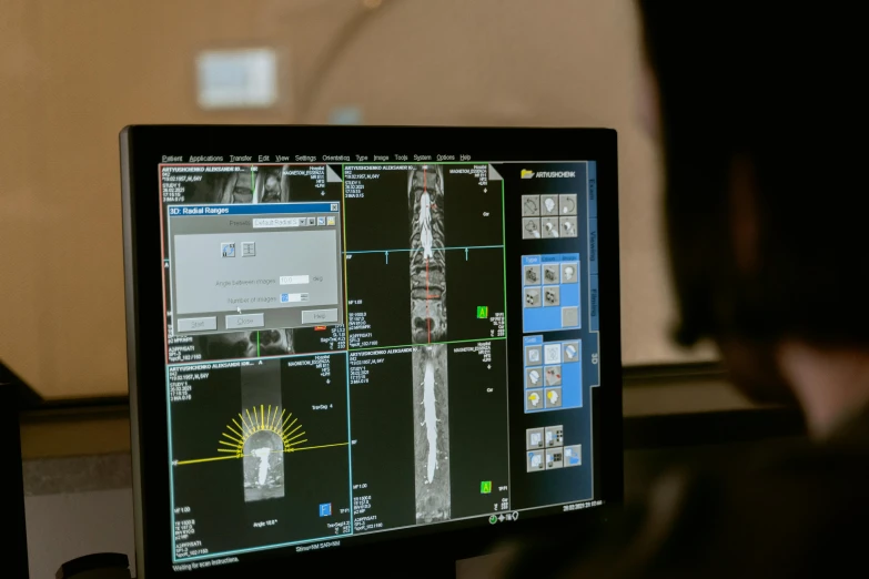 a man sitting in front of a computer monitor, pexels, holography, surgical equipment, high detailed thin stalagtites, navigation command center, shot from a distance