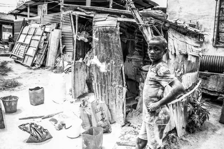 a black and white photo of a woman standing in front of a shack, by Kevin Connor, pexels contest winner, auto-destructive art, portrait of a patchwork boy, belongings strewn about, african man, super intricate