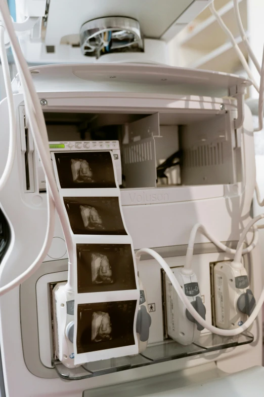 a medical device sitting on top of a table, x-ray photography, panels, brown, cavities