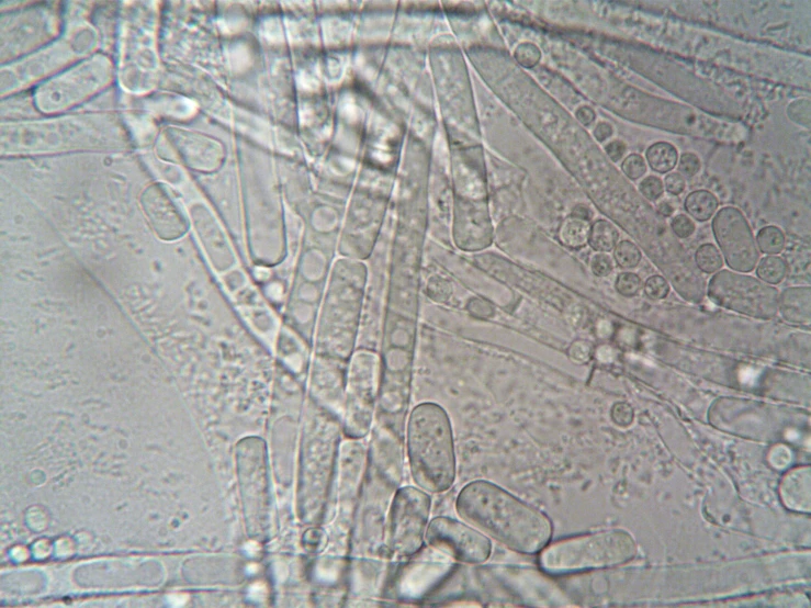 a close up of a plant with a lot of water on it, a microscopic photo, by Alison Watt, hurufiyya, bone plants, cell - shaded, taken in the mid 2000s, photo taken in 2018