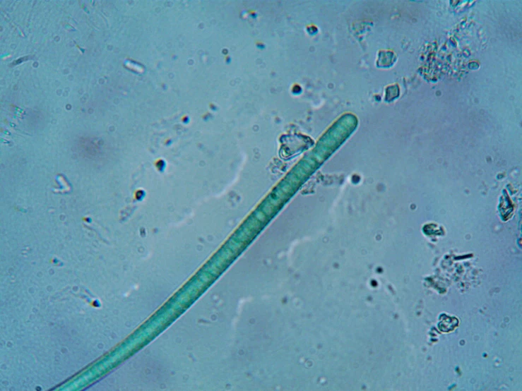 a green algae under a microscope lens, long wispy tentacles, 1 male, warts, dug stanat