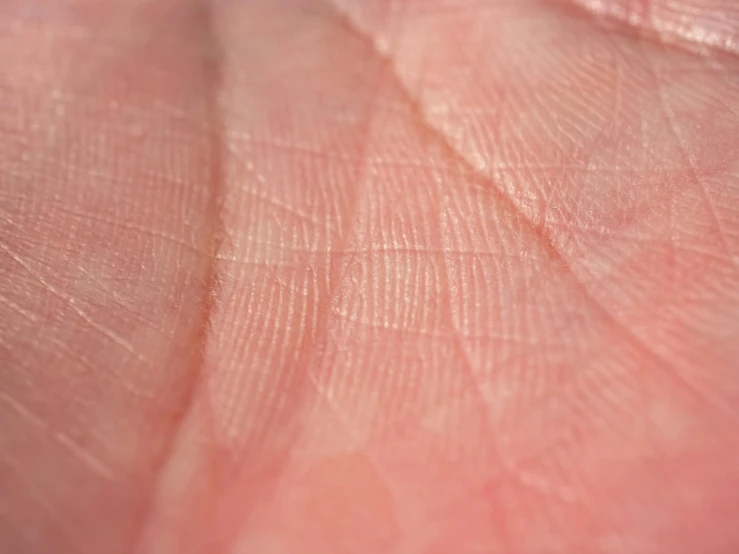 a close up of a person's hand with a bug on it, a macro photograph, by Daniel Lieske, pexels, hyperrealism, wrinkled muscles skin, smooth pink skin, pallid skin, an intricate