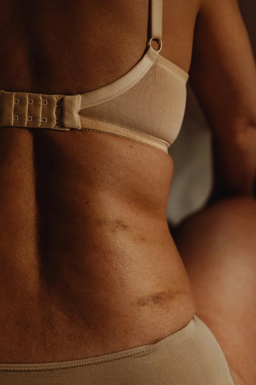 a woman in her underwear showing her scar on her stomach