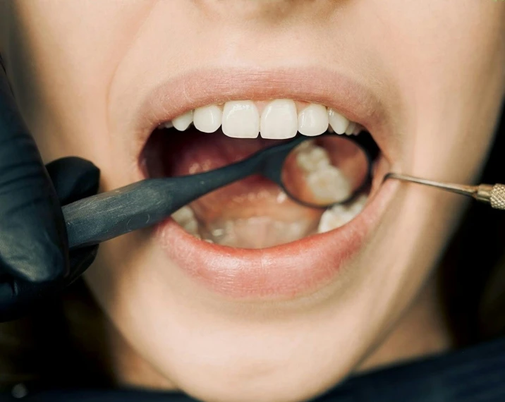 a woman taking her teeth brushed with a pair of scissors