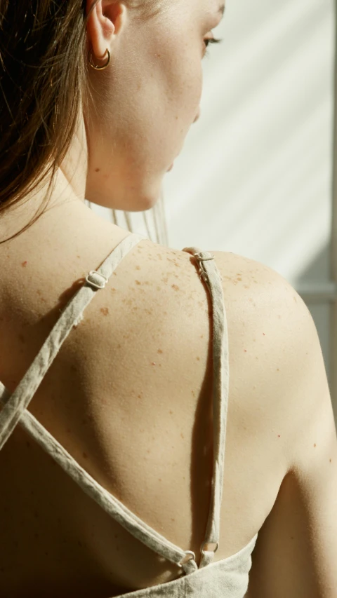 a woman with freckles stands in front of a window