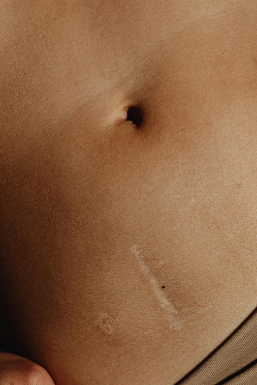 an image of a womans stomach in the process of showing cell phone app on her stomach