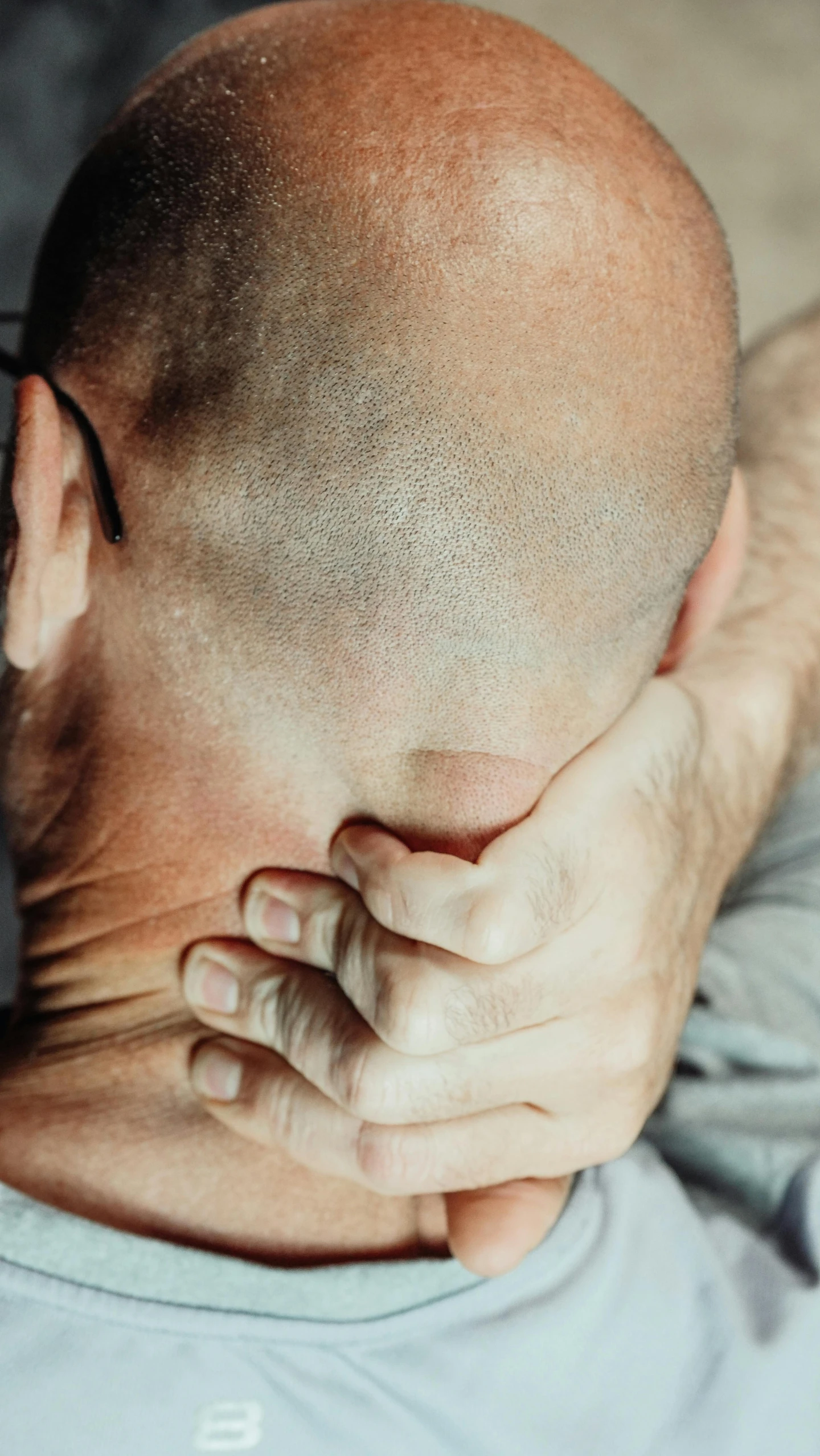 the top of the head of a bald man with his hand on his face