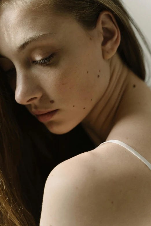 a girl with some spots on her skin looks off to the side