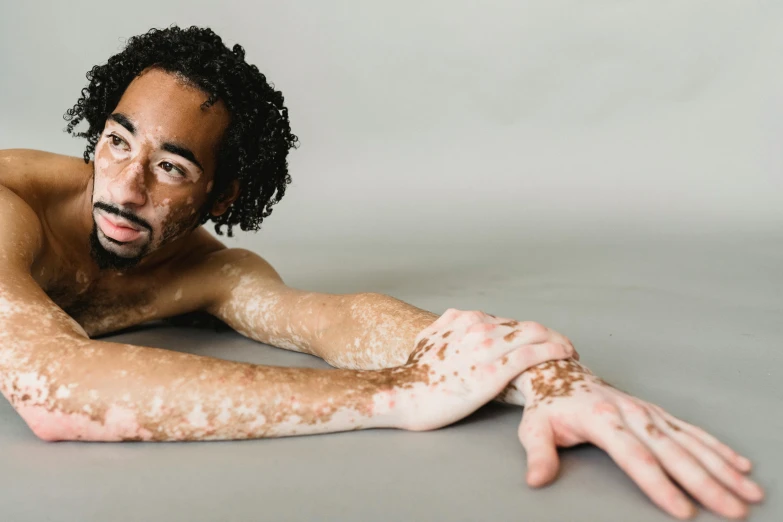 a  man with freckles on his body and arms