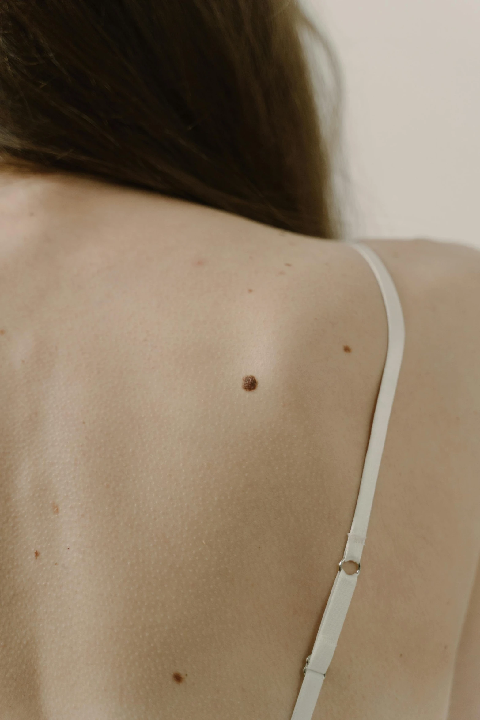 a woman with small bumps on her back