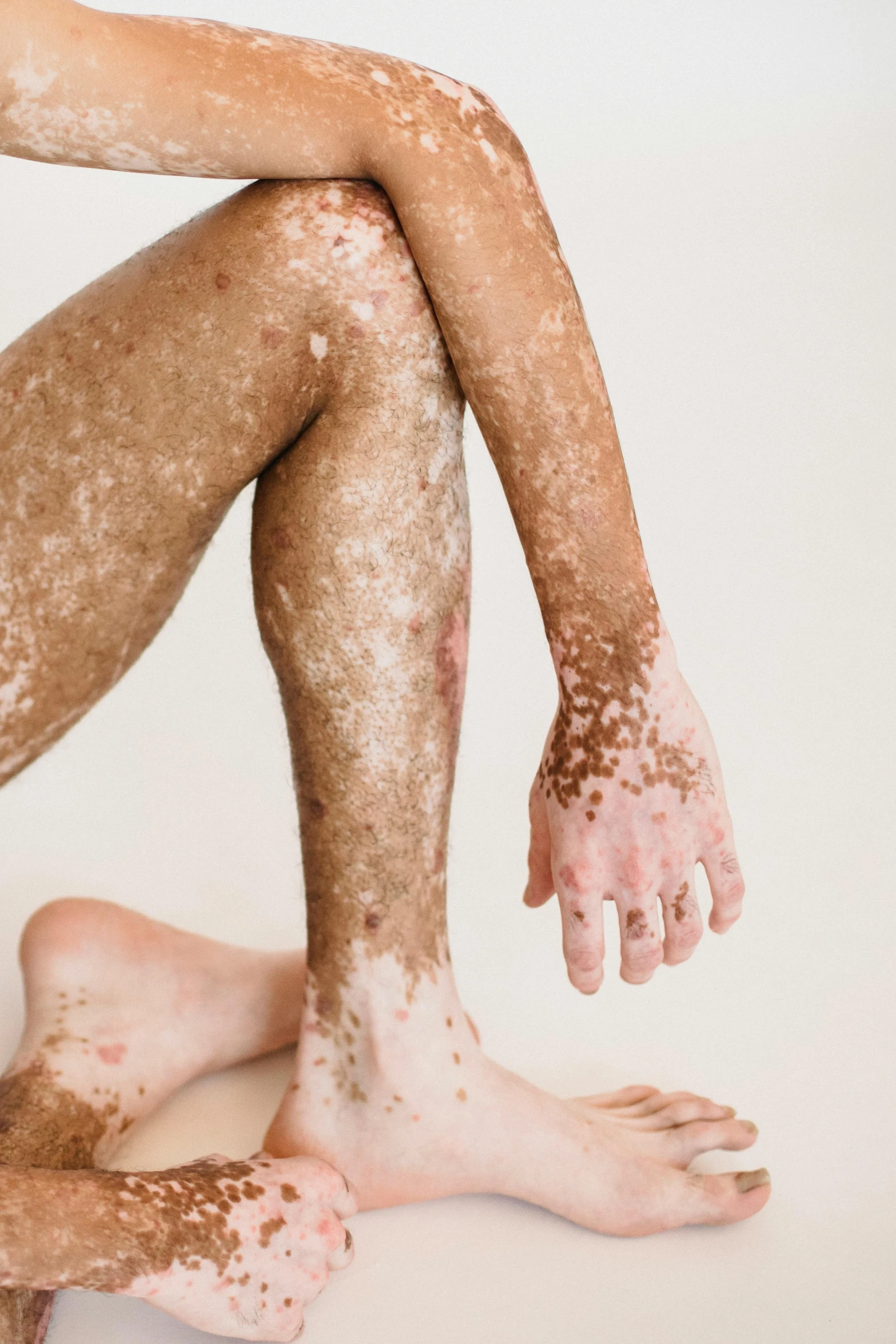 the legs and leg area of a man covered in mud