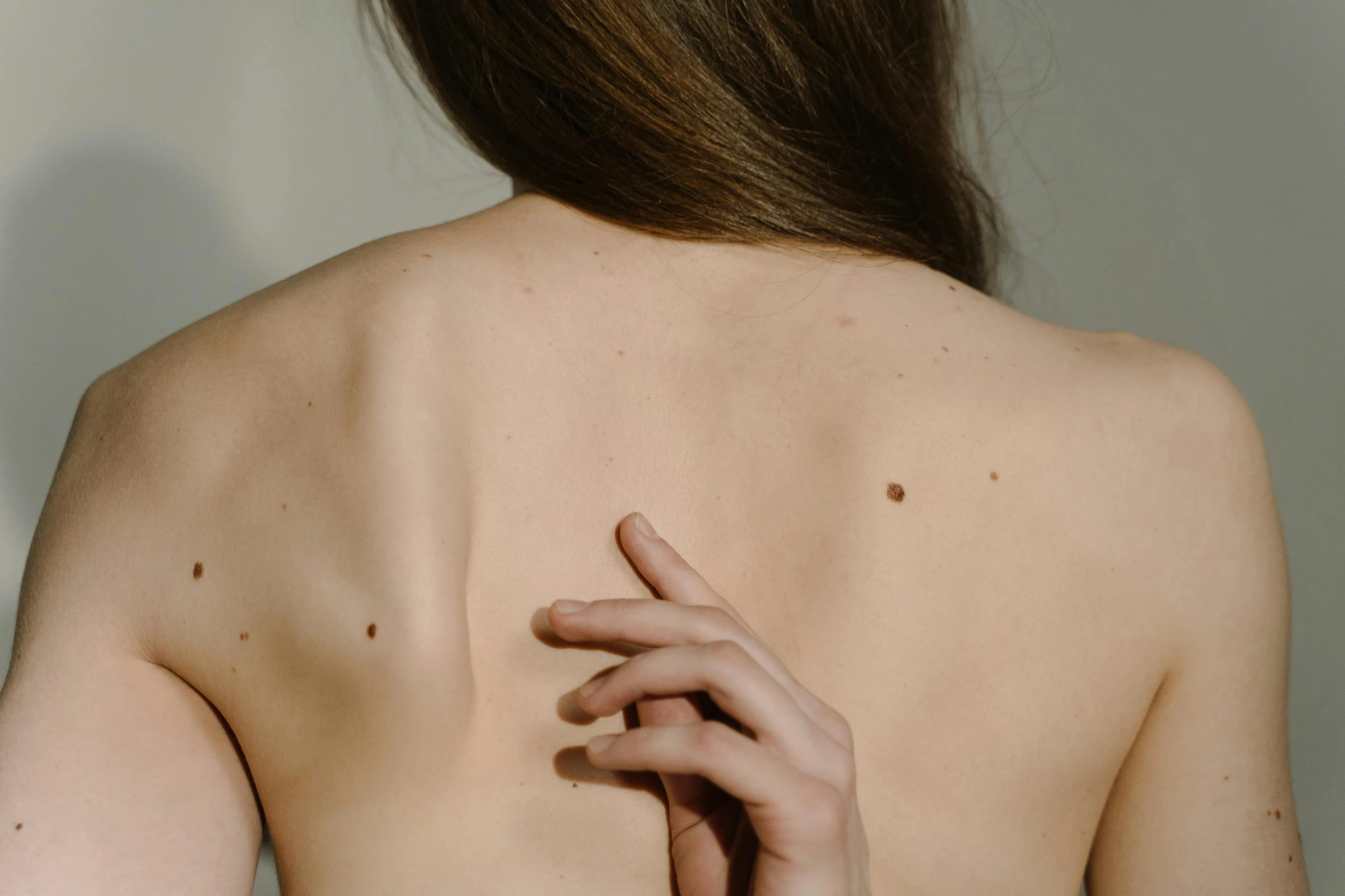 the back of a woman's  with spots on it