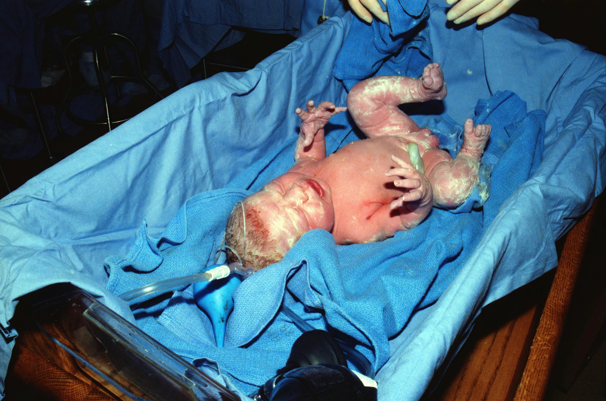 a baby lying on it's back with hair drying on